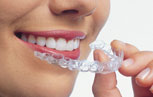 Invisalign